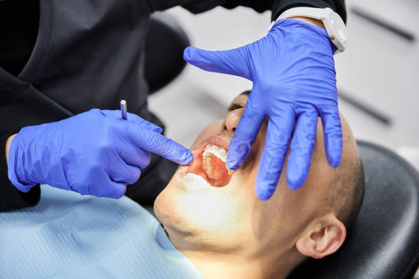 Best Emergency Tooth Extraction in West Point, NE