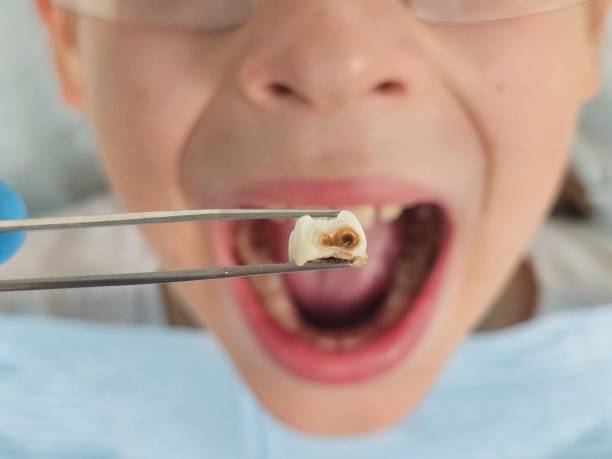 Best Pediatric Emergency Dentist in West Point, NE